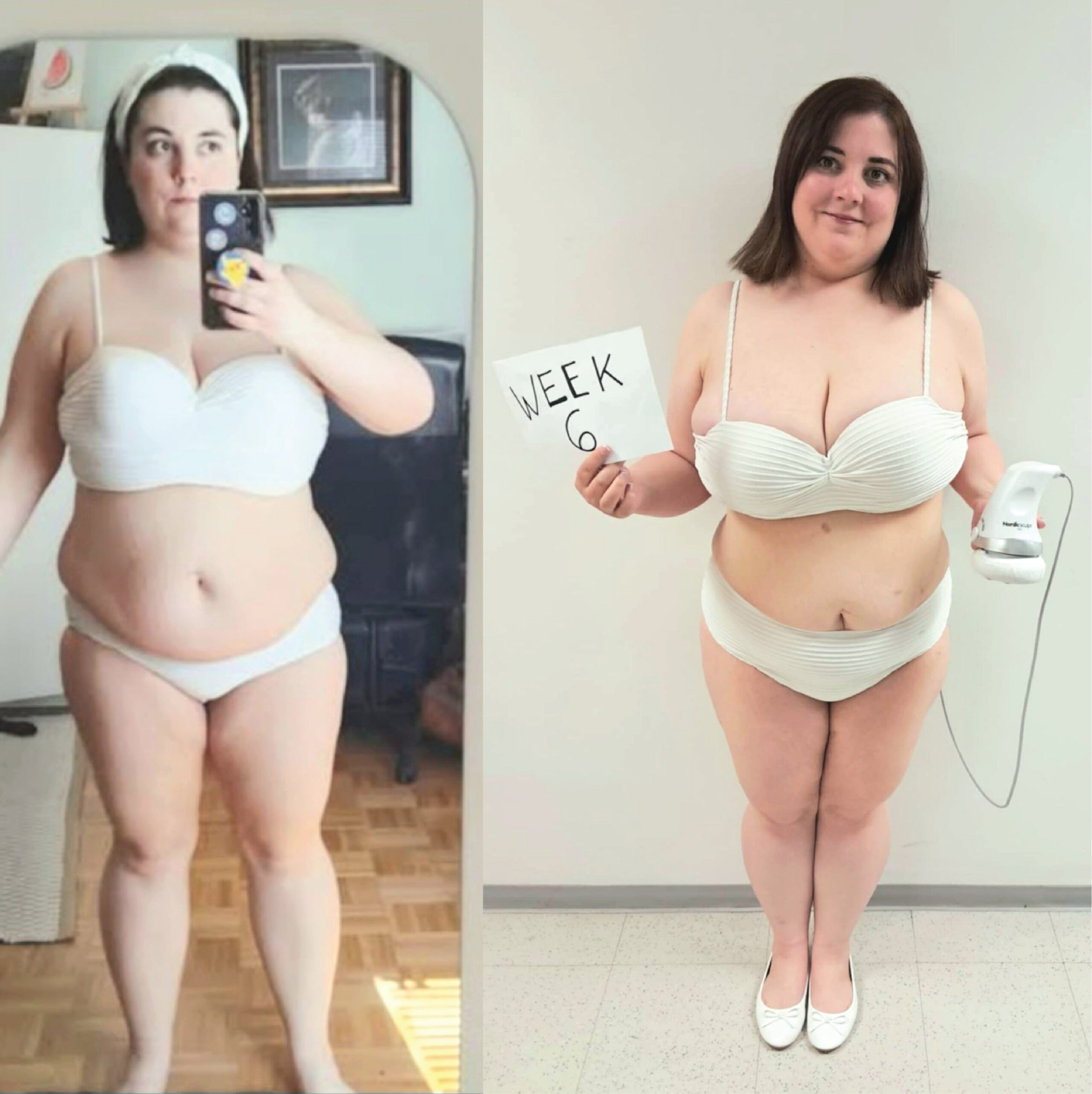 Before and After Results