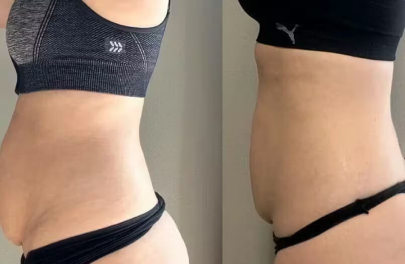 Image #1 from Barbara White