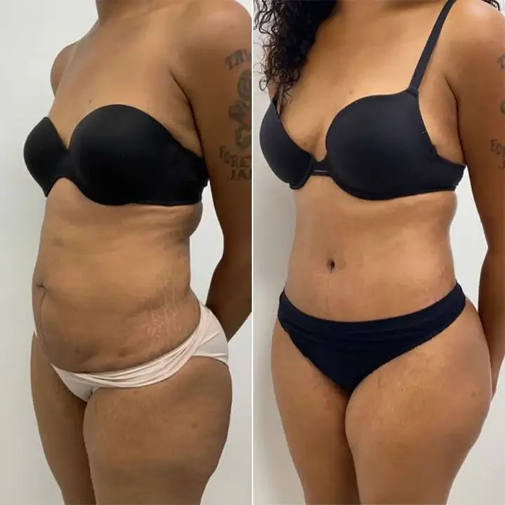 12-Week Transformation